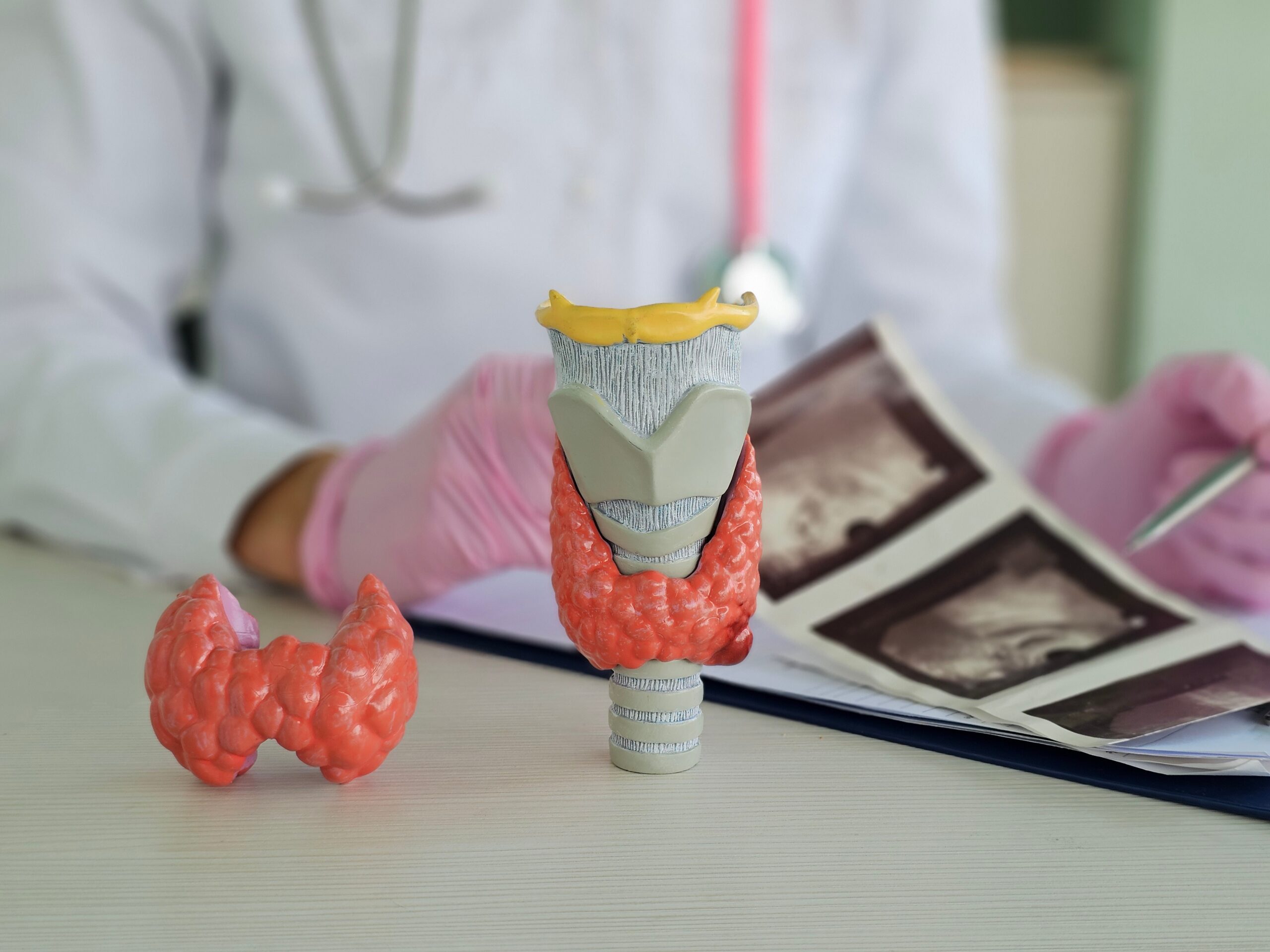 Hipotireoidismo: o que causa, como tratar e por que ele afeta seu metabolismo